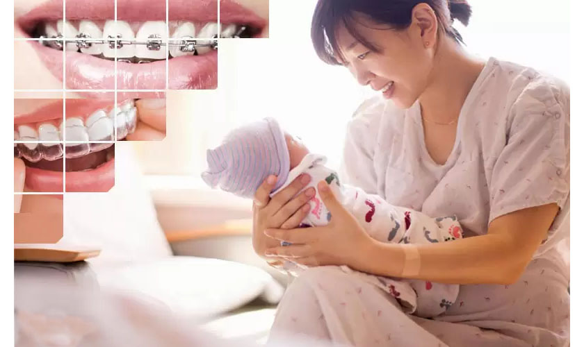Niềng răng sau sinh có được không