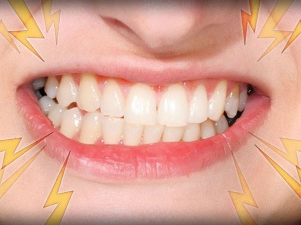 Cách chữa nghiến răng khi ngủ dân gian như thế nào cho hiệu quả? | bài thuốc Đông y chữa nghiến răng khi ngủ Phụ Nữ & Gia Đình