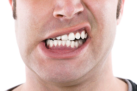 Các Phương Pháp Chữa Nghiến Răng Khi Ngủ Hiệu Quả Nhất - bài thuốc Đông y chữa nghiến răng khi ngủ