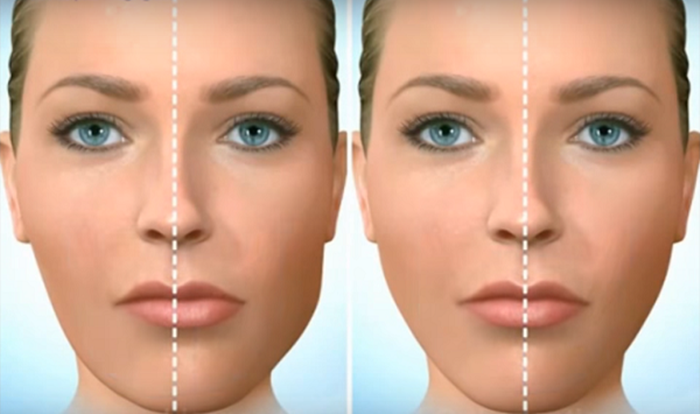 Thế nào là khớp cắn chuẩn? Điều trị bằng cách nào cho gương mặt đẹp cân đối?
