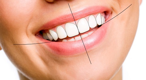Hàm răng đẹp là như thế nào? Các yếu tố nào quyết định?