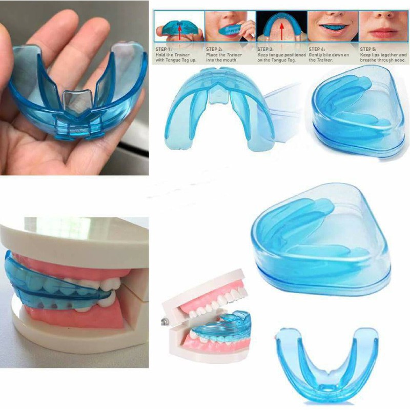 Dụng cụ niềng răng tại nhà an toàn, chất lượng - Tẩy trắng răng | review dụng cụ niềng răng tại nhà