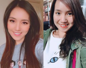 Răng khểnh đẹp hay xấu