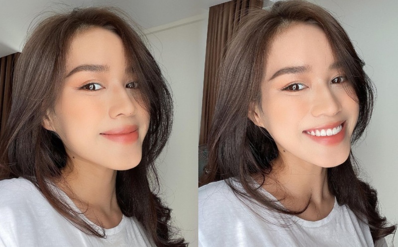 Tháo niềng răng có đau không