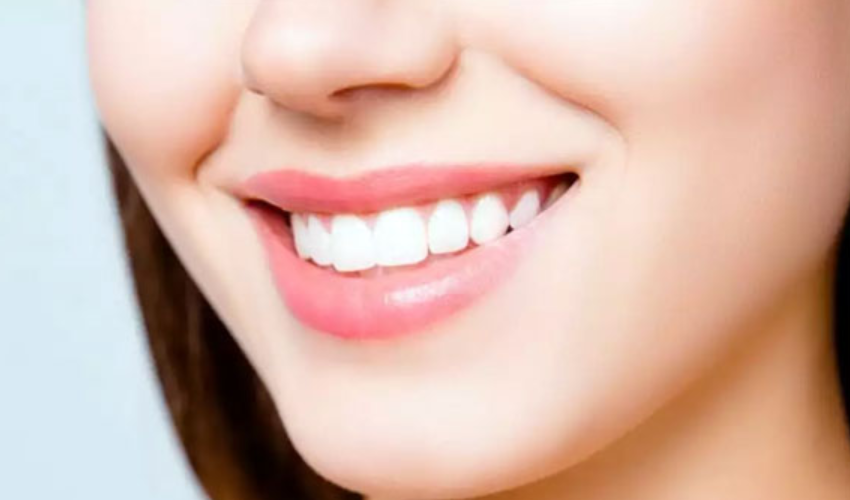 Tiêu chuẩn của một hàm răng đẹp